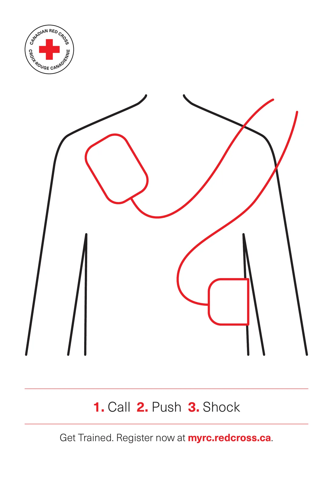 Call, Push, Shock poster from the Canadian Red Cross showing where to place AED pads on the chest